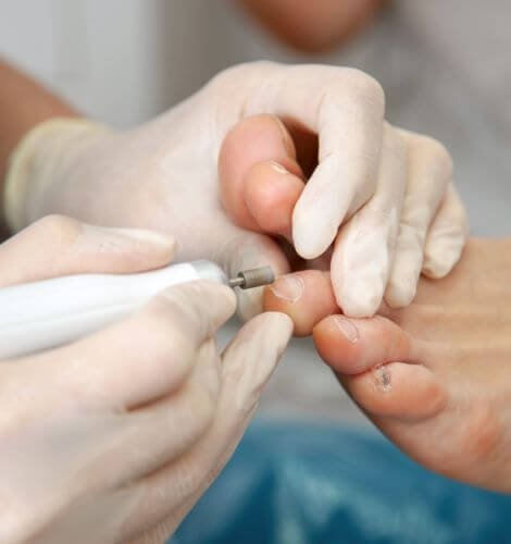 foto podologia preventiva